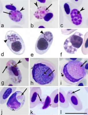  Isospora ! Un Parasite Intracellulaire Qui Donne Du Fil à Retordre aux Systèmes Digestifs